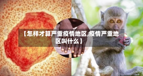 【怎样才算严重疫情地区,疫情严重地区叫什么】